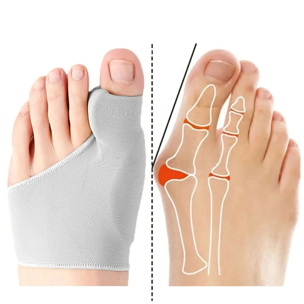 1/2Pair Toe Separator Hallux V - Ankle Brace Sock avaliação e preço