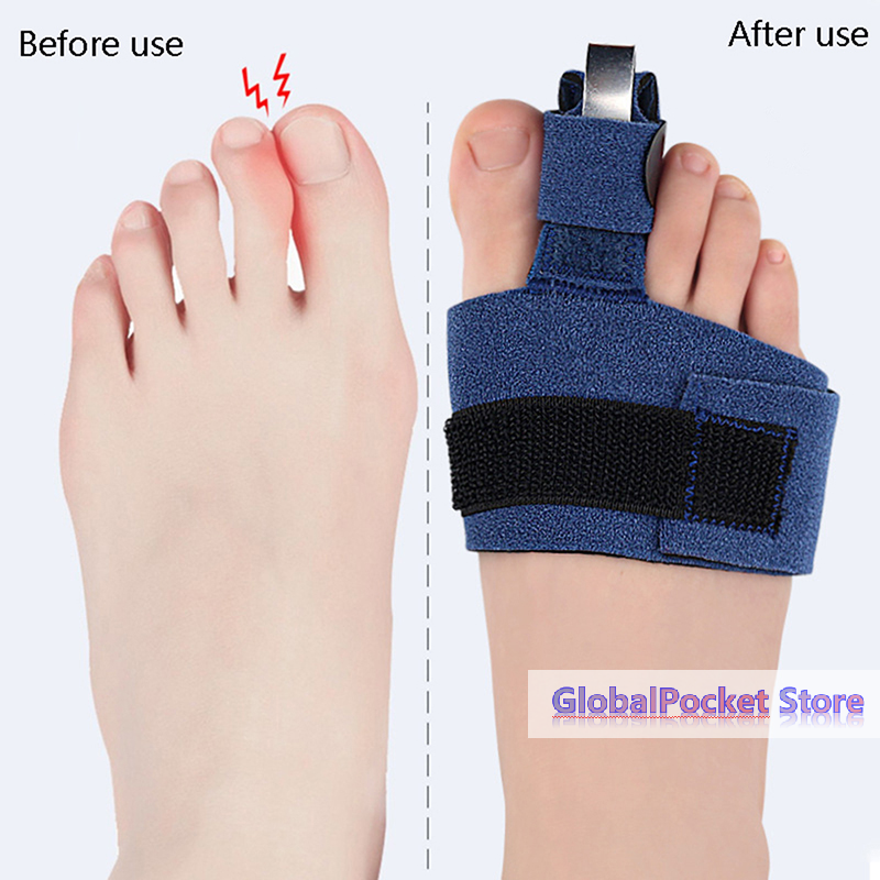 1Pcs Toe Corrector Toe Fractur - Ankle Brace Sock avaliação e preço
